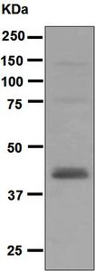 Western blot analysis on MCF-7 cell lysate using anti-Rad51B antibody.