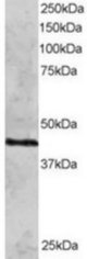 RAD51C antibody staining (2 ug/ml) of HeLa lysate (RIPA buffer, 30g total protein per lane). Primary incubated for 12 hour. Detected by Western blot of chemiluminescence.