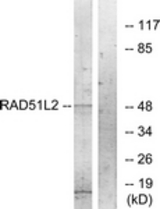 Western blot of extracts from COS7 cells, using RAD51L2 Antibody. The lane on the right was incubated with synthetic peptide.