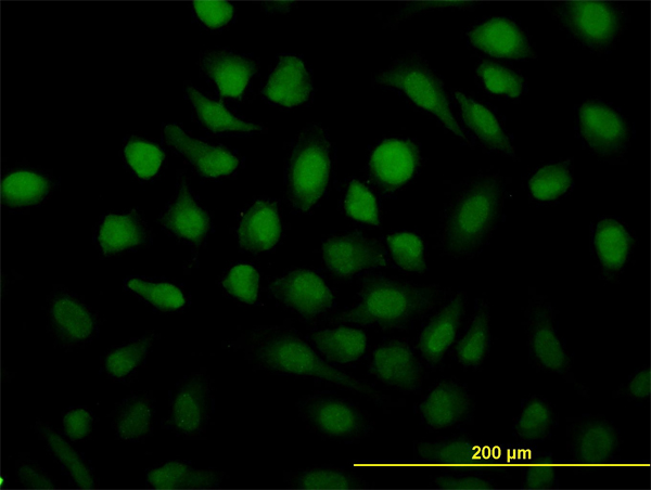 Immunofluorescence of monoclonal antibody to RAD51C on HeLa cell. [antibody concentration 10 ug/ml]