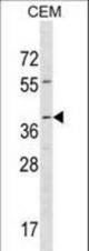 RAD52 Antibody western blot of CEM cell line lysates (35 ug/lane). The RAD52 antibody detected the RAD52 protein (arrow).