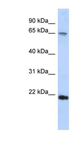 RAD54B antibody LS-C101410 Western blot of HepG2 cell lysate.