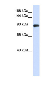 RAD54B antibody LS-C101628 Western blot of Jurkat lysate.