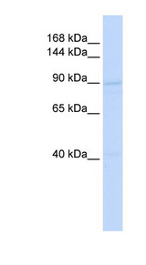 RAD54B antibody LS-C101629 Western blot of HeLa lysate.