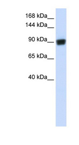 RAD54B antibody LS-C110153 Western blot of Fetal Brain lysate.