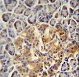 PRSS3 antibody immunohistochemistry of formalin-fixed and paraffin-embedded human pancreas tissue followed by peroxidase-conjugated secondary antibody and DAB staining.
