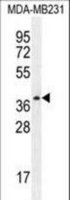 PRSS3 Antibody western blot of MDA-MB231 cell line lysates (35 ug/lane). The PRSS3 antibody detected the PRSS3 protein (arrow).