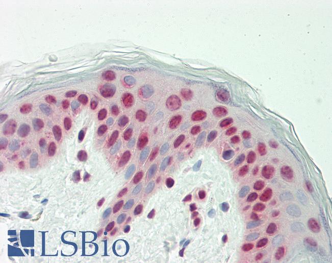 Human Skin: Formalin-Fixed, Paraffin-Embedded (FFPE)