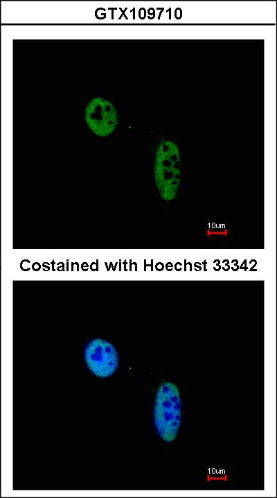 Immunofluorescence of paraformaldehyde-fixed HeLa using RAG2 antibody at 1:200 dilution.