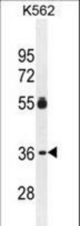ESSPL Antibody western blot of K562 cell line lysates (35 ug/lane). The ESSPL antibody detected the ESSPL protein (arrow).