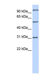 RAI14 antibody LS-C102609 Western blot of MCF7 cell lysate.