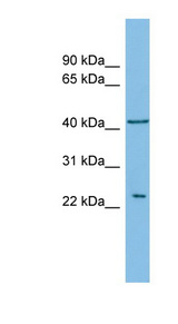 RALB antibody LS-C116643 Western blot of ACHN lysate.