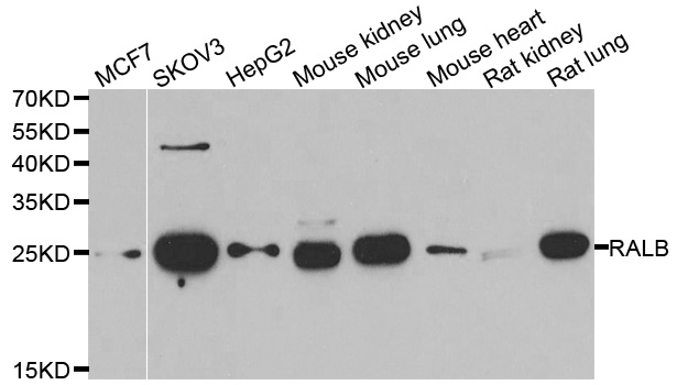 Western blot analysis of extracts of various cell lines, using RALB antibody.