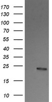 HEK293T cells were transfected with the pCMV6-ENTRY control (Left lane) or pCMV6-ENTRY RALB (Right lane) cDNA for 48 hrs and lysed. Equivalent amounts of cell lysates (5 ug per lane) were separated by SDS-PAGE and immunoblotted with anti-RALB.
