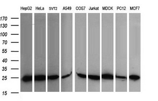 Western blot of extracts (35 ug) from 9 different cell lines by using anti-RALB monoclonal antibody (HepG2: human; HeLa: human; SVT2: mouse; A549: human; COS7: monkey; Jurkat: human; MDCK: canine; PC12: rat; MCF7: human).