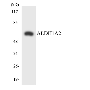 Western blot of the lysates from COLO205 cells using ALDH1A2 antibody.