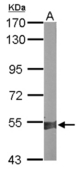 Sample (50 ug of whole cell lysate). A: mouse liver. 7.5% SDS PAGE. RALDH2 / ALDH1A2 antibody diluted at 1:10000.
