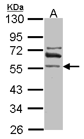 Sample (30 ug of whole cell lysate). A: IMR32. 10% SDS PAGE. RALDH2 / ALDH1A2 antibody diluted at 1:1000.
