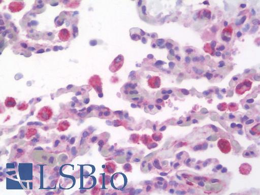 Anti-RALDH2 / ALDH1A2 antibody IHC staining of human lung. Immunohistochemistry of formalin-fixed, paraffin-embedded tissue after heat-induced antigen retrieval. Antibody LS-B9869 concentration 10 ug/ml.