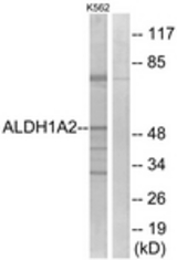 Western blot of extracts from K562 cells, using ALDH1A2 Antibody. The lane on the right is treated with the synthesized peptide.