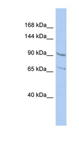 RALGDS antibody LS-C111870 Western blot of HepG2 cell lysate.