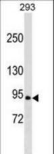 RALGDS Antibody western blot of 293 cell line lysates (35 ug/lane). The RALGDS antibody detected the RALGDS protein (arrow).