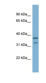 RALGPS2 antibody LS-C108035 Western blot of MCF7 cell lysate.