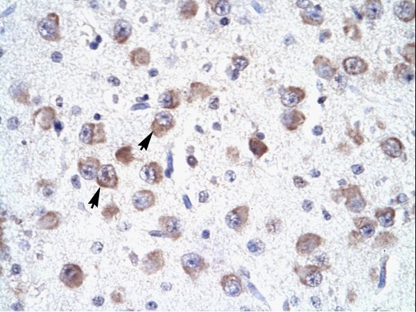 RALY antibody LS-C29833 was used in IHC to stain formalin-fixed, paraffin-embedded human brain.