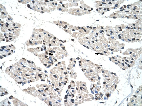 RALY antibody LS-C31877 was used in IHC to stain formalin-fixed, paraffin-embedded human muscle.