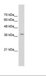 Jurkat Cell Lysate