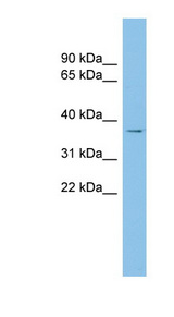 RALY antibody LS-C115965 Western blot of COLO205 cell lysate.