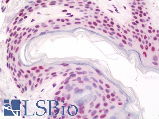 Anti-RALY antibody IHC staining of human skin. Immunohistochemistry of formalin-fixed, paraffin-embedded tissue after heat-induced antigen retrieval. Antibody LS-B11433 concentration 20 ug/ml.