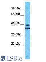 PRSS55 antibody Western Blot of HepG2. Antibody dilution: 1 ug/ml.
