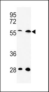 Western blot of C13orf3 Antibody in HeLa, 293 cell line lysates (35 ug/lane). C13orf3 (arrow) was detected using the purified antibody.