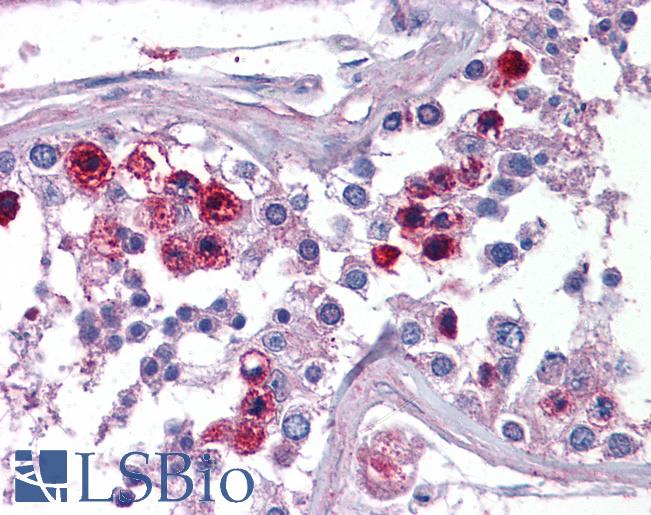 Anti-SKA3 antibody IHC of human testis. Immunohistochemistry of formalin-fixed, paraffin-embedded tissue after heat-induced antigen retrieval. Antibody LS-B5039 concentration 5 ug/ml.
