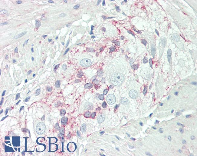 Human Colon, Myenteric Plexus: Formalin-Fixed, Paraffin-Embedded (FFPE)