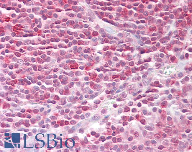 Anti-RAN antibody IHC of human tonsil. Immunohistochemistry of formalin-fixed, paraffin-embedded tissue after heat-induced antigen retrieval. Antibody LS-B7616 concentration 20 ug/ml.