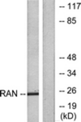 Western blot of extracts from LOVO cells, using RAN Antibody. The lane on the right is treated with the synthesized peptide.