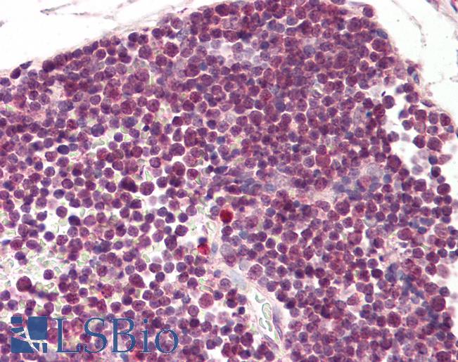 Anti-RAN antibody IHC of human thymus. Immunohistochemistry of formalin-fixed, paraffin-embedded tissue after heat-induced antigen retrieval. Antibody LS-B8294 dilution 3.75 ug/ml.