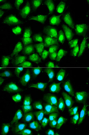 Immunofluorescence analysis of HeLa cell using RAN antibody. Blue: DAPI for nuclear staining.