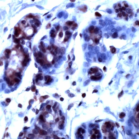 Human breast stained with Anti-Ran