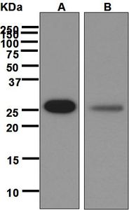 Western blot analysis on (A) HepG2 and (B) HeLa cell lysates using anti-RanBP1 antibody.