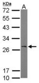 Sample (50 ug of whole cell lysate). A: Mouse brain. 12% SDS PAGE. RANBP1 antibody diluted at 1:1000.
