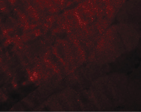Immunofluorescence of RANBP10 in mouse skeletal muscle tissue with RANBP10 antibody at 20 ug/ml.