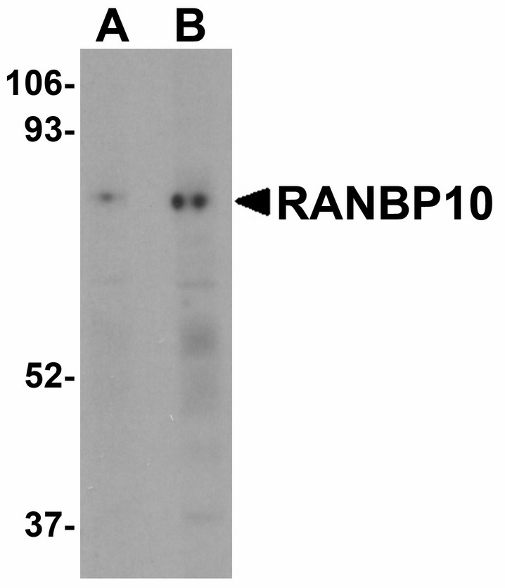 Western blot of RANBP10 in human skeletal muscle tissue lysate with RANBP10 antibody at (A) 1 and (B) 2 ug/ml.