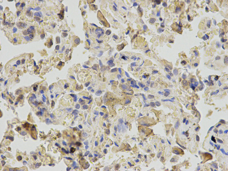Immunohistochemistry of paraffin-embedded human lung using RANGAP1 antibody at dilution of 1:200 (400x lens).