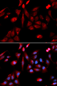 Immunofluorescence analysis of U20S cell using RANGAP1 antibody. Blue: DAPI for nuclear staining.