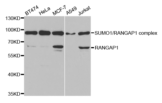 Western blot analysis of extracts of various cell lines, using RANGAP1 antibody.