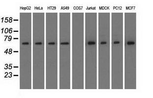 Western blot of extracts (35 ug) from 9 different cell lines by using anti-RANGAP1 monoclonal antibody.