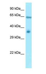 RANGAP1 antibody Western Blot of Mouse Heart.